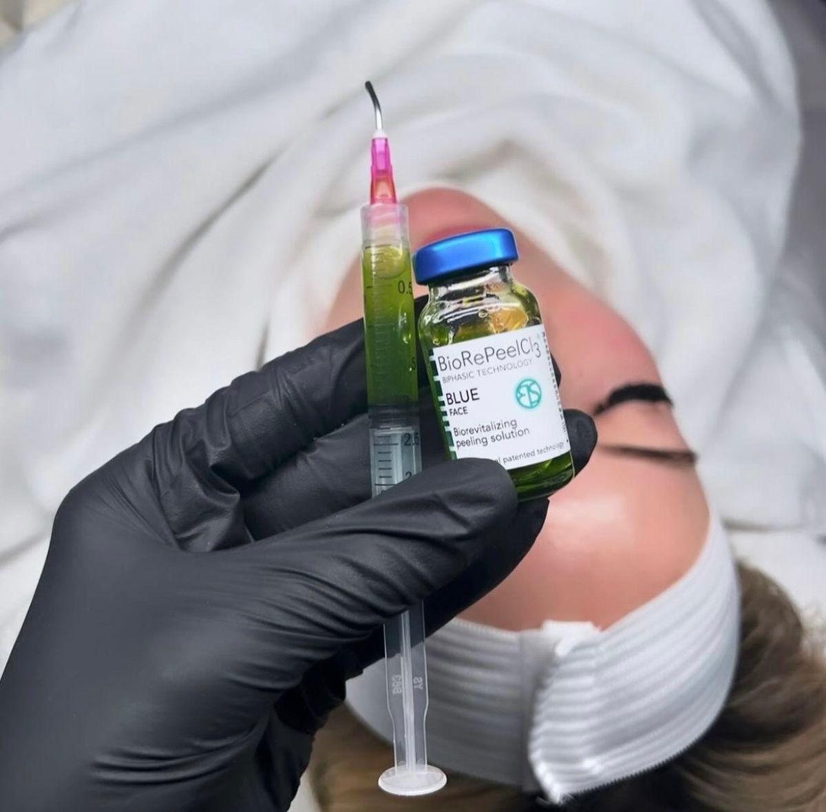 Chemical peel solution prepared for treatment