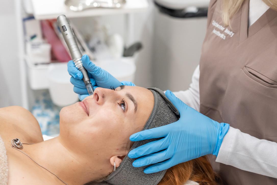 Microneedling treatment in a Group clinic