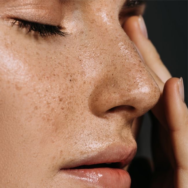 Close-up of facial skin